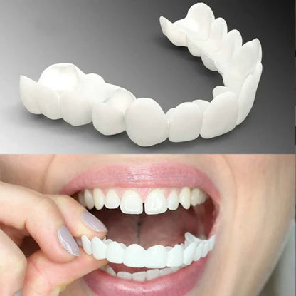 🦷 غطاء أسنان قابل للتركيب – ابتسامة طبيعية في ثوانٍ